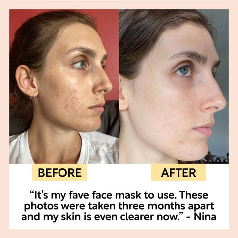 Kaolin Clay Cleansing Face Mask